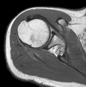 Clinical Page 2 Shoulder