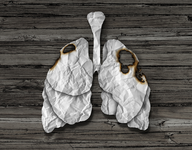 Human Lung Cancer Concept